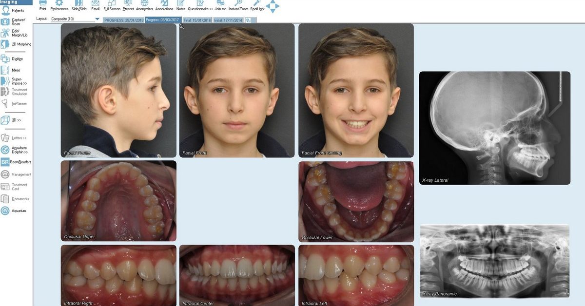 caso ortodontico