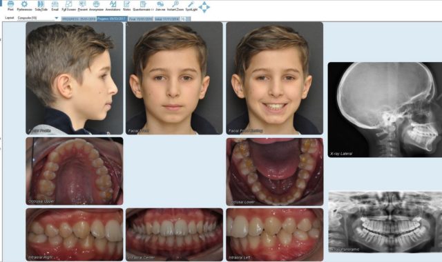 caso ortodontico